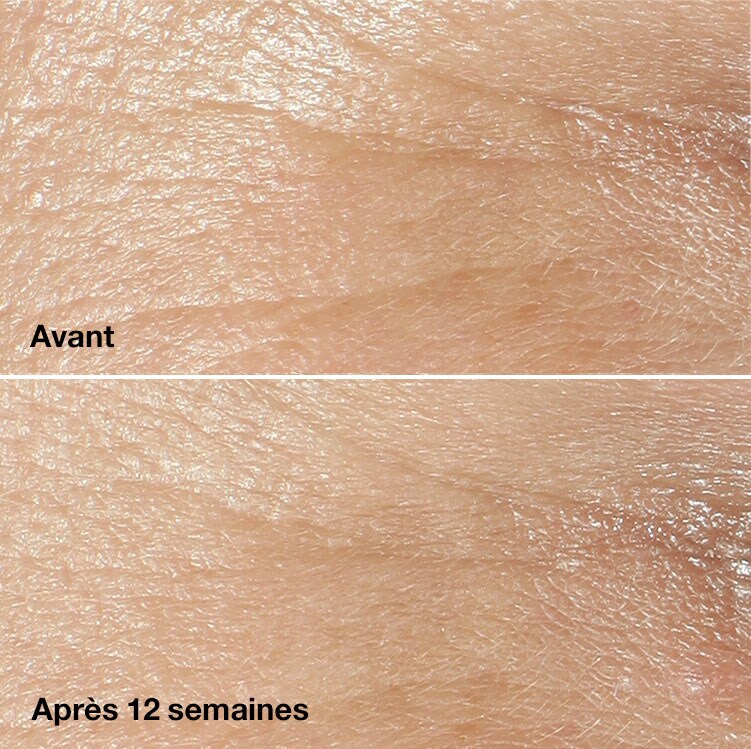 Découvrez l’évolution.